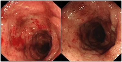 Post-COVID-19 polyautoimmunity – Fact or coincidence: A case report
